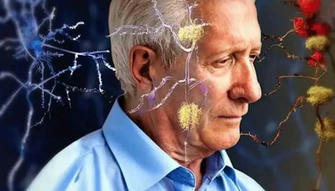 Six Ways to Prevent Alzheimer's